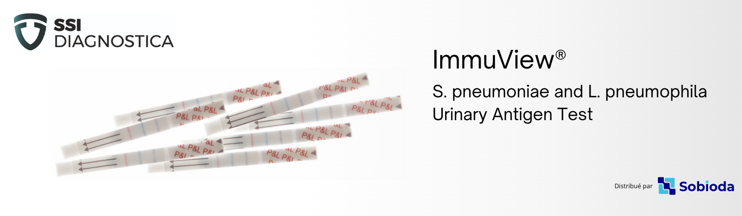 Les infections à S. pneumoniae et L. pneumophila